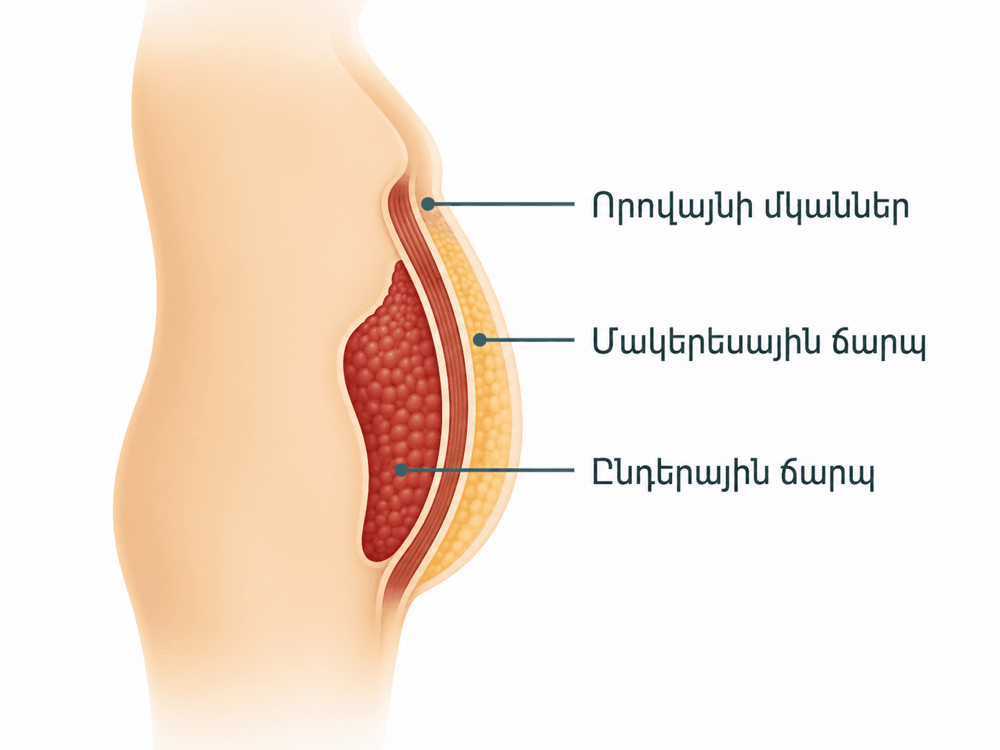Որովայնային տիպի ճարպակալում